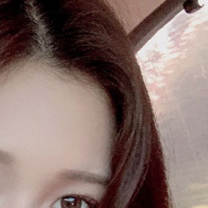 눈성형외과 내게 맞는 눈성형을 찾아요 관련 이미지 10