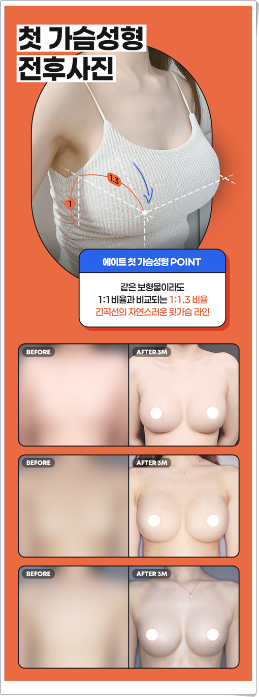 What Is the Average Cost (Price) of Breast Augmentation Surgery? image 10