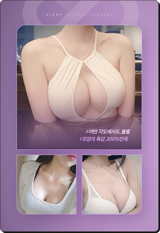 Breast Augmentation Types and Methods, Implant Costs, Pros and Cons image 18