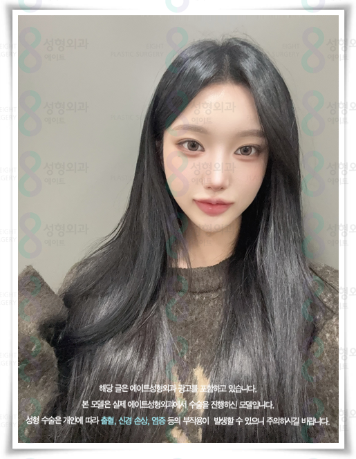 코끝수술 잘하는곳, 예쁜 후기, 가격 정보, 콧볼축소 뭐가 다른가요? 관련 이미지 3