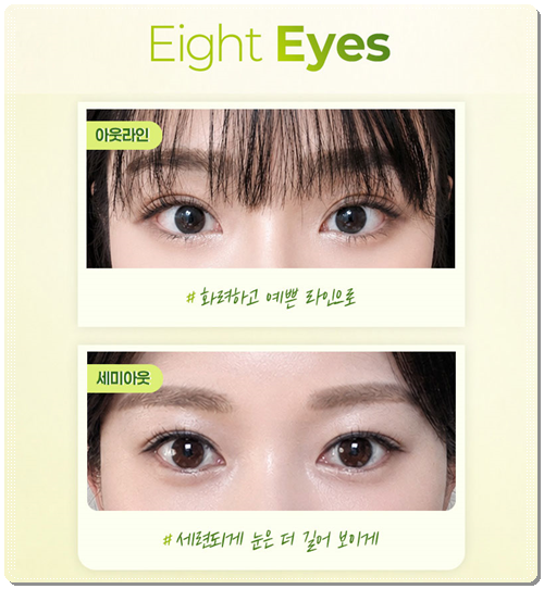 Why Choose Partial Incision Instead of Non-Incision Double-Eyelid Surgery? Meaning, Cost, and When Does the Swelling Go Down? image 9