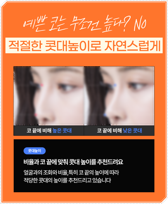 남자 코성형 종류 어떤 게 맞을까? 평균 비용부터 회복기간, 발품 팁까지 완벽 가이드 관련 이미지 24