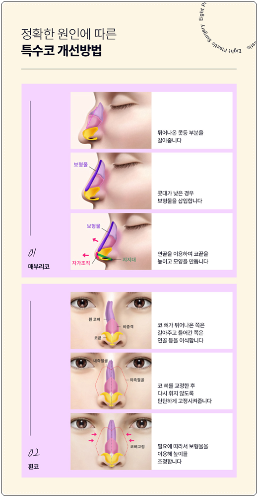 What Is Important When Looking Into the Cost of Hump Nose Surgery and Correction Reviews? image 17
