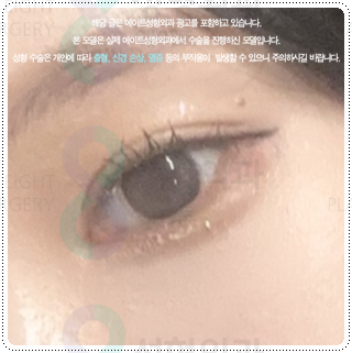 Natural Double Eyelid Surgery Using the Non-Incisional Method: A Budget and Consultation Guide for Middle School Students’ Eye Shapes Before and After Surgery image 5