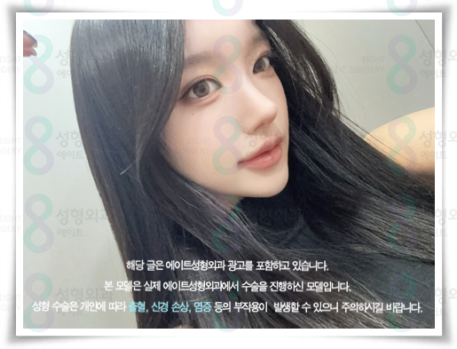 코끝수술 잘하는곳, 예쁜 후기, 가격 정보, 콧볼축소 뭐가 다른가요? 관련 이미지 5