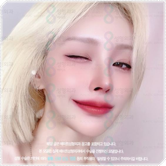 How Much Does a Non-Implant Tip Rhinoplasty Cost? Types of Materials Used in Nose Surgery and How It Differs from Bridge Surgery image 5