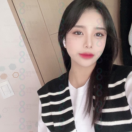 Famous Clinic for Nose Revision Surgery&nbsp;Best Place for Nose Revision Surgery in Gangnam&nbsp;Famous Place for Nose Revision Surgery in Seoul image 3