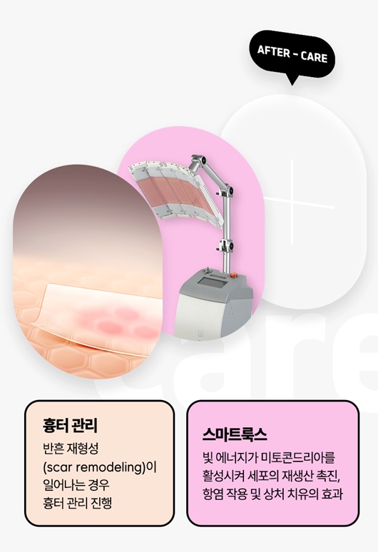 What Is the Difference Between Breast Ptosis Surgery and Breast Augmentation? image 9