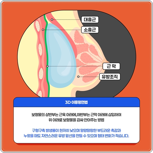 How much does breast augmentation surgery cost? image 9
