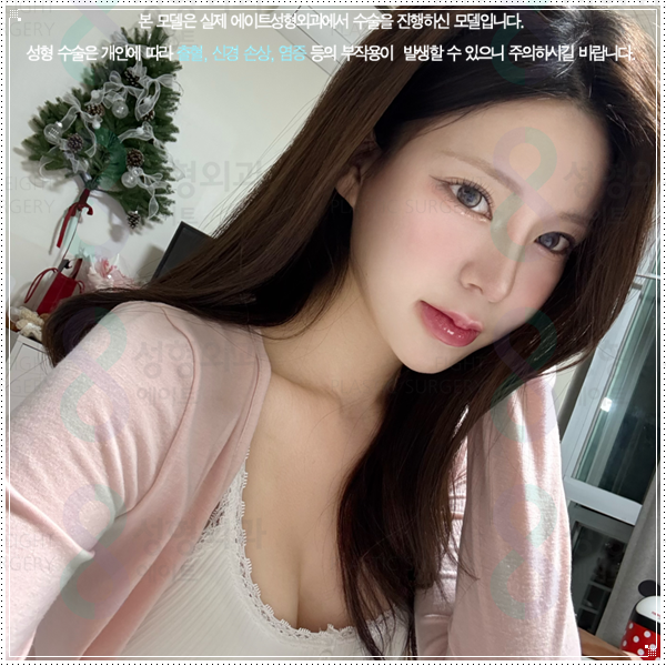 여자와 남자의 코성형 수술 차이점과 비용, 보형물 선택 가이드 관련 이미지 2