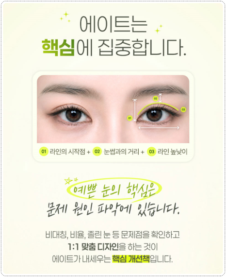 Natural Double Eyelid Surgery Using the Non-Incisional Method: A Budget and Consultation Guide for Middle School Students’ Eye Shapes Before and After Surgery image 8