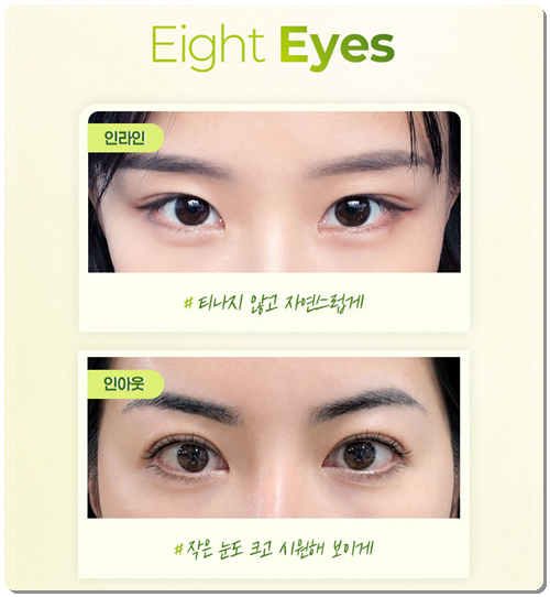 Why Choose Partial Incision Instead of Non-Incision Double-Eyelid Surgery? Meaning, Cost, and When Does the Swelling Go Down? image 8