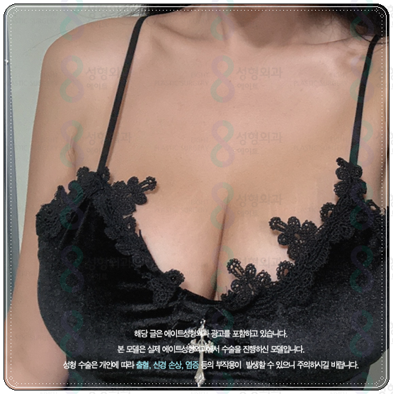 처진가슴수술 비용 (가격), 처짐 개선 방법은? 후기, 회복기간 어떤가요? 관련 이미지 1
