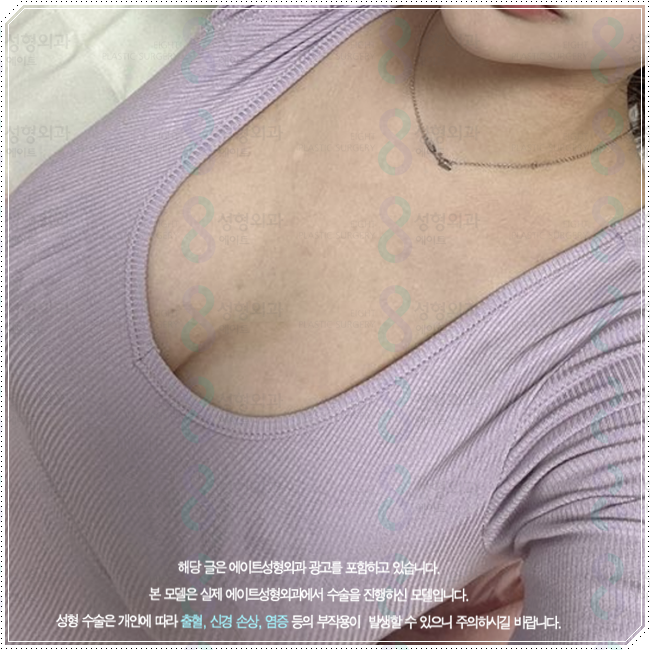 How Much Does Sagging Breast Surgery Cost? A Summary of Improvement Methods, Reviews, and Recovery Time image 2