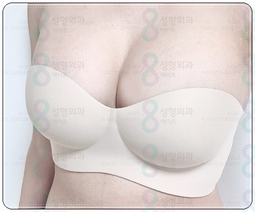 If You're Looking Into Breast Augmentation Cost Reviews, Be Sure to Read This image 3
