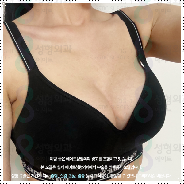 멘토 부스트 평균적인 가격, 작은 가슴 키우는 성형 방법과 수술 후 회복은? 관련 이미지 4