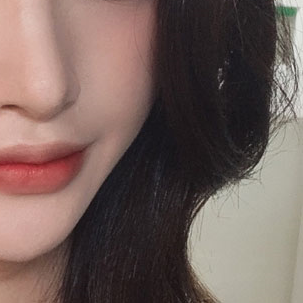 눈성형외과 내게 맞는 눈성형을 찾아요 관련 이미지 16