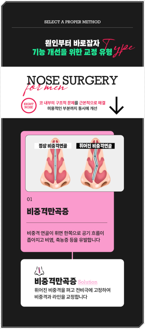 남자 코성형 종류 어떤 게 맞을까? 평균 비용부터 회복기간, 발품 팁까지 완벽 가이드 관련 이미지 13