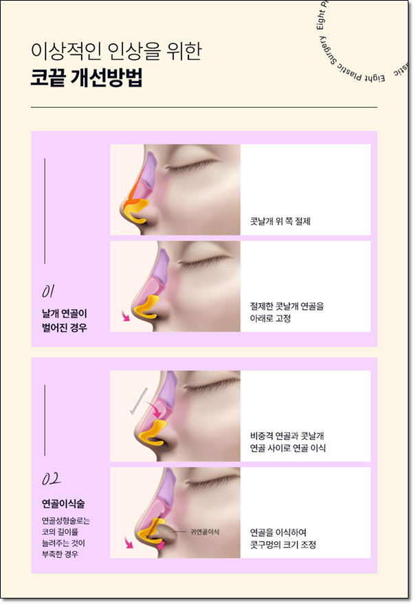 남자와 여자 차이? 매부리코는 수술 가격이 다를까요? 관련 이미지 11