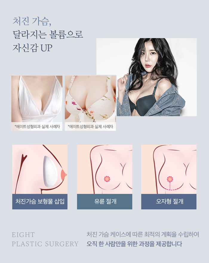 처진가슴교정 밸런스와 탄력을 함께 고려해 관련 이미지 5