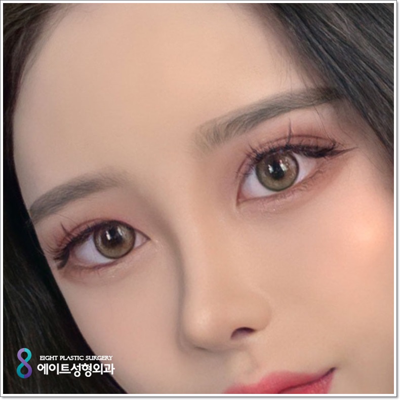 What Are the Criteria for Finding a Good Eye Surgery Clinic? image 1