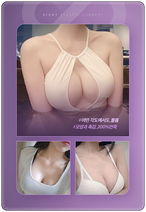 Motiva Breast Augmentation Review: What Are the Pros and Cons of the Implant? image 14