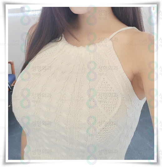 Best Places for Breast Augmentation: A Summary of Breast Implant Types, Pros, and Cons image 2