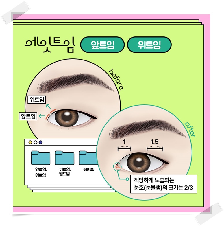 앞트임비용 얼마인지 알아보려면 관련 이미지 4
