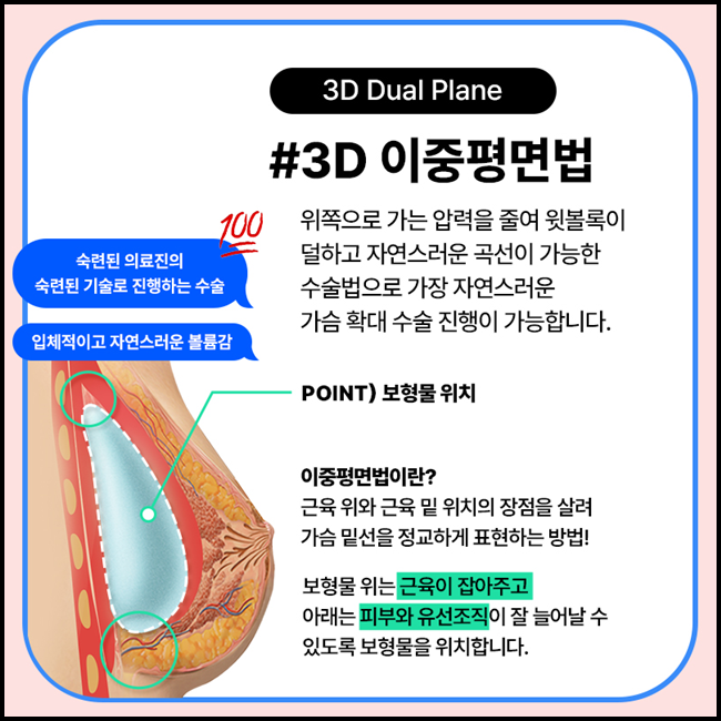 가슴보형물종류 나에게 맞는것을 찾기위해 관련 이미지 9