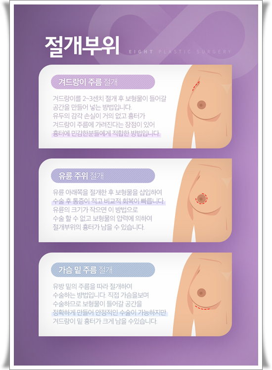 가슴확대 수술 가격, 보형물 종류 차이가 있나요? 관련 이미지 18