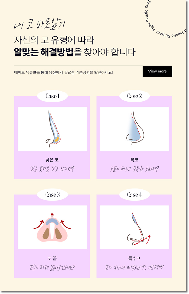 남자와 여자 차이? 매부리코는 수술 가격이 다를까요? 관련 이미지 7