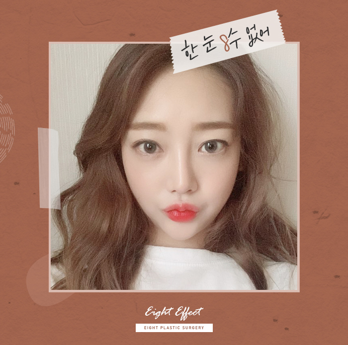 에이트성형외과의원 볼륨감 있는 몸매로 관련 이미지 6