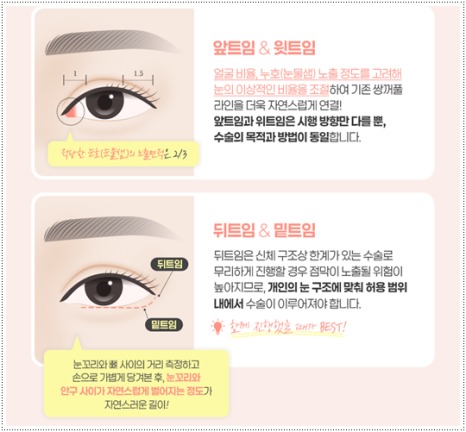 What Are the Prices and Combined Effects of Epicanthoplasty and Upper Epicanthoplasty with Double Eyelid Surgery? From Eye Shape Changes in Reviews of Front-and-Upper Epicanthoplasty to the Differences image 12