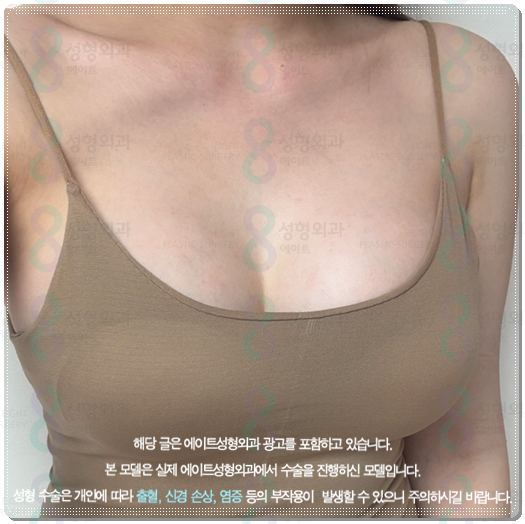 가슴 확대수술 비용, 후기 공유, 종류와 통증 붓기 기간까지 관련 이미지 5