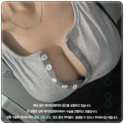 멘토 부스트 가격(비용) 가슴성형 후기 비교 촉감 정말 좋나요? 관련 이미지 3