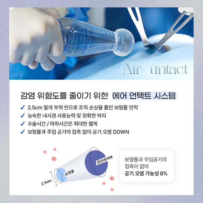 물방울가슴성형비용 멘토CPG는 얼마정도할까요?? 관련 이미지 5