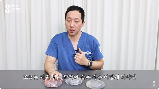 Mentor Boost: How Is It Different from Existing Mentor Implants? Eight Plastic Surgery Clinic image 21
