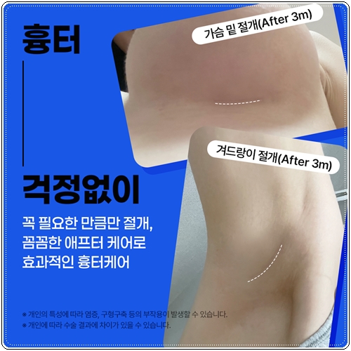 How much does breast augmentation surgery cost? image 8