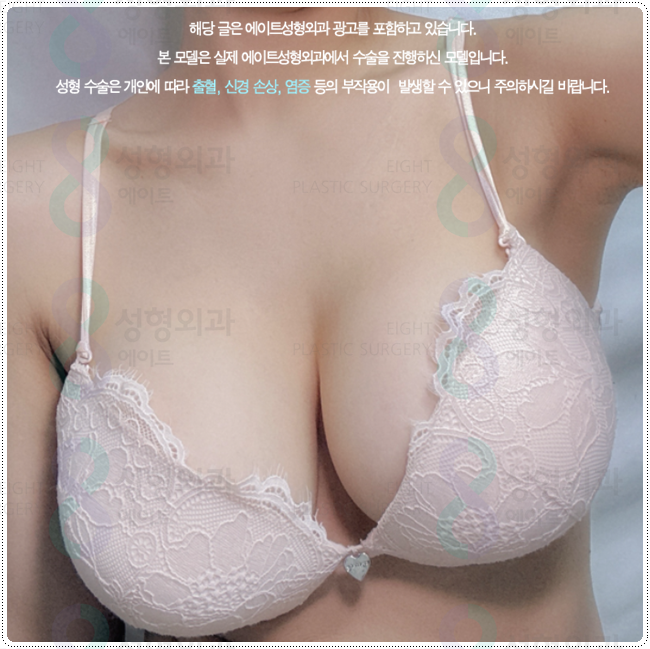 Why Should You Consider the Implant and Cost Together When Comparing Motiva Breast Augmentation Prices? image 2