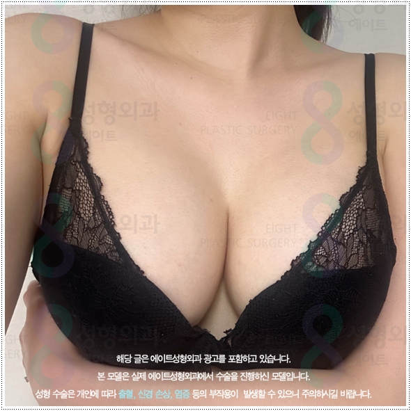 수술 비용이 부담되나요? 가슴수술 준비할 때 처진 가슴은 어떤 방법이 좋나요? 관련 이미지 1