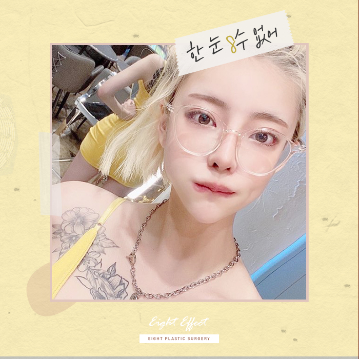 V라인사각턱 자갈턱 돌려깎기 관련 이미지 2