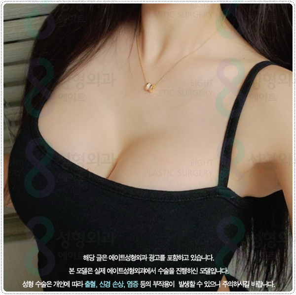 가슴 재수술 흉터, 통증 걱정이 될 때, 알맞은 시기와 생생한 후기 찾아보기 관련 이미지 5
