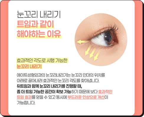 앞트임을 고민할 때, 눈매에 따라 달라지는 선택 관련 이미지 9