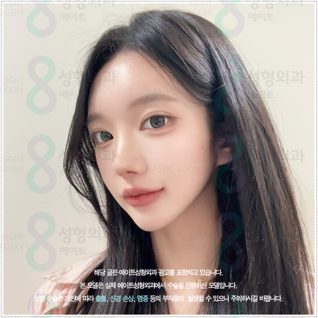 What Types of Rhinoplasty Are Available in Apgujeong? A Look at Bridge and Tip Surgery Prices and Recovery Times image 5