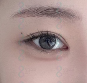 Hospitals That Are Good at Eye Plastic Surgery, Places That Are Good at Double Eyelid Surgery, Gangnam Places Good at Double Eyelid Surgery image 1