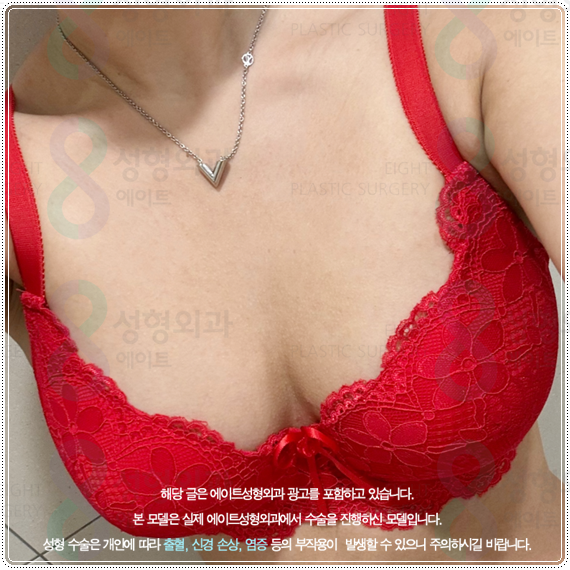 How to Find a Well-Known Breast Plastic Surgery Clinic in Seoul’s Gangnam District: Selection Criteria and Points to Check image 3
