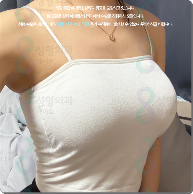압구정역 가슴수술, 성형외과 추천? 멘토 엑스트라는 비용 전에 가슴 트레이닝센터, 의사를 확인 관련 이미지 5