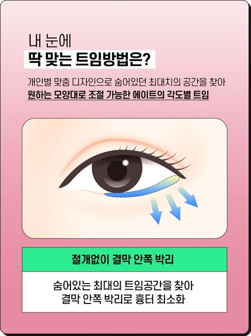 If You Have Been Looking Into Outer Corner and Lower Corner Eye Surgery Reviews, and Eye Corner Surgery Prices image 6