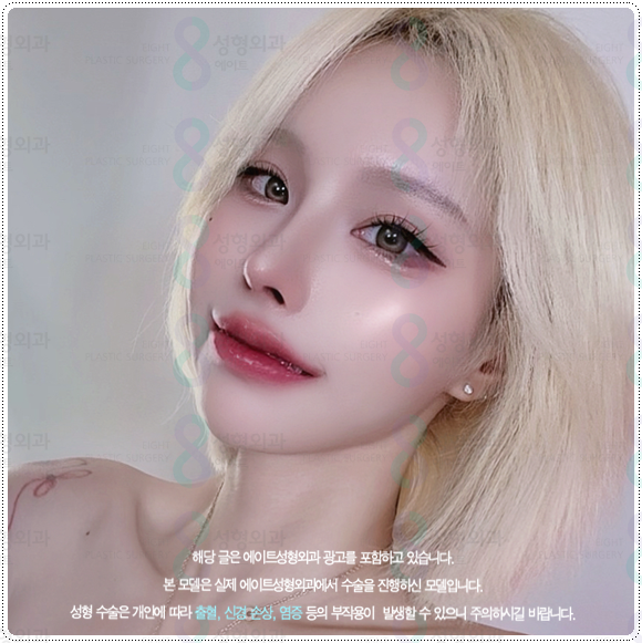 복코성형 콧볼축소 1개월 차! 코성형 붓기 빨리 빼는법과 코끝수술 후기 찾으셨나요? 관련 이미지 3