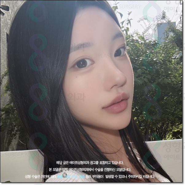 남자와 여자 차이? 매부리코는 수술 가격이 다를까요? 관련 이미지 5